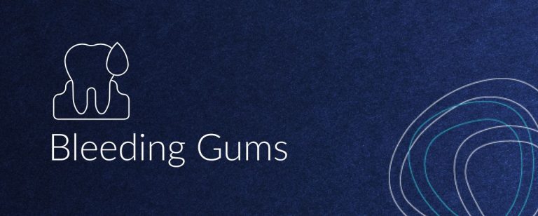 Bleeding Gums - Medland Dental Symptoms